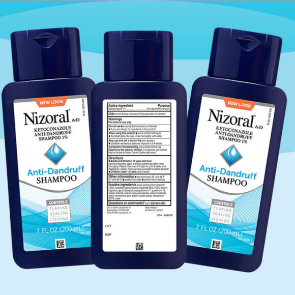 How To Get Rid of Forehead Fungal Acne and Get Skin Clear Again- Nizoal (Ketokonazole) Anti fungal face and body wash