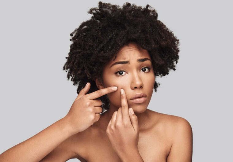 Fungal Acne vs Closed Comedones What's The Difference_Header_african female_popping comedone