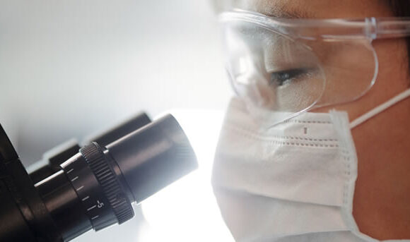 A close-up of a sebaceous gland hyperplasia bump on the skin with a magnifying glass and a doctor examining it