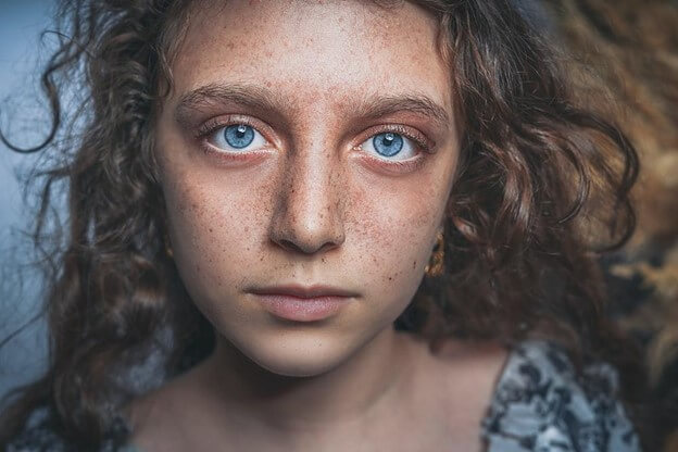 Female with blue eyes - Face Free from Fungal Acne Natural Treatments
