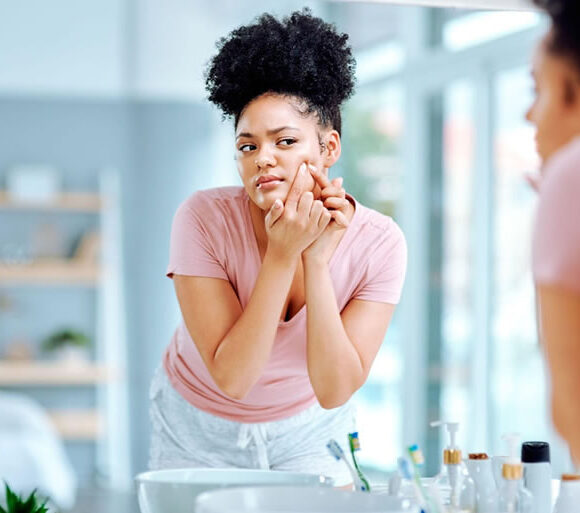 Retinol-and-its-Effectiveness-in-Treating-Fungal-Acne