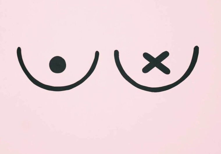 Differentiating Between Acne and Breast Cancer Symptoms