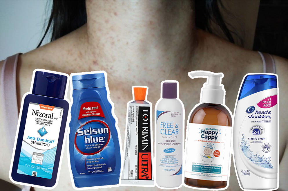 The best fungal acne treatments - (Malassezia folliculitis) products