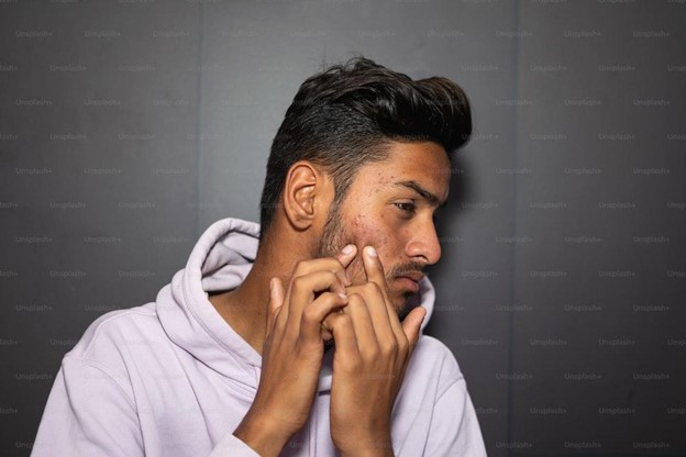 male_with_itchy_acne_popping_pimple